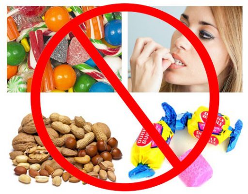 Bạn nên hạn chế những đồ ăn quá cứng hoặc quá dai để tránh tình trạng bong mắc cài và giảm áp lực lên răng Bạn nên hạn chế những đồ ăn quá cứng hoặc quá dai để tránh tình trạng bong mắc cài và giảm áp lực lên răng