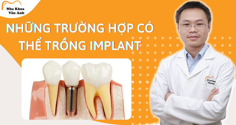 nhung-truong-hop-co-the-trong-implant