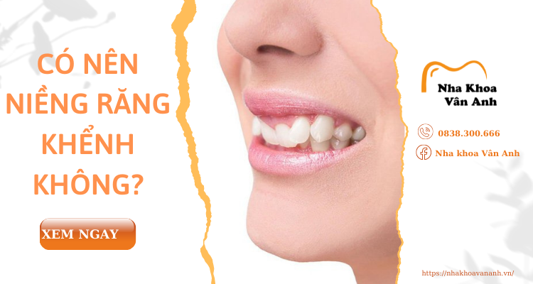 co-nen-nieng-rang-khenh-khong