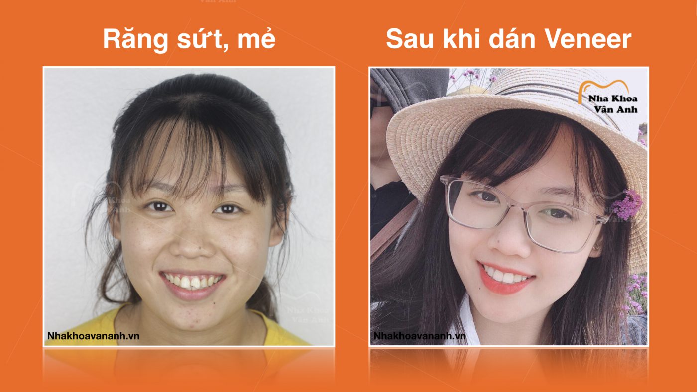 Khách hàng tại Nha Khoa Vân Anh