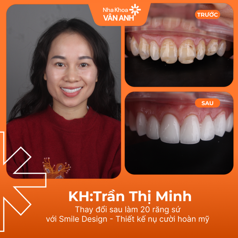 kh-nguyen-thi-minh