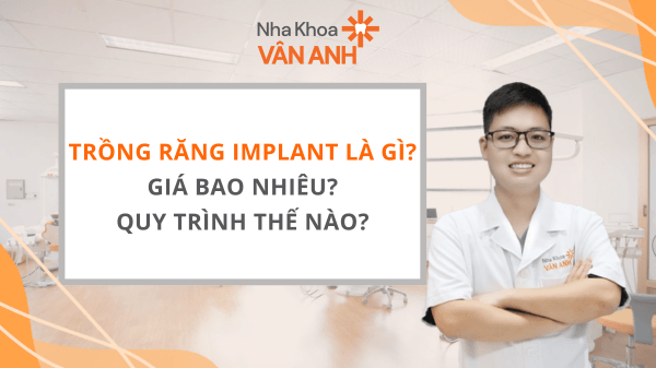 Trồng răng Implant là gì