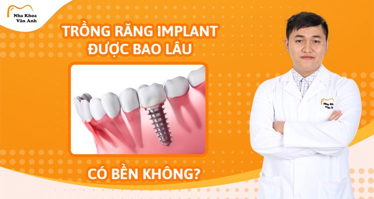 trong-rang-implant-