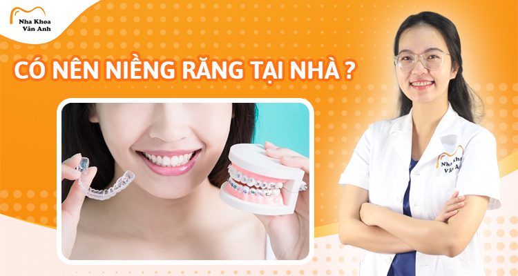 niềng răng tại nhà