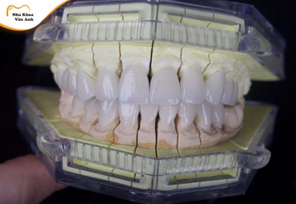 boc-rang-su-co-an-uong-binh-thuong-duoc-khong-7