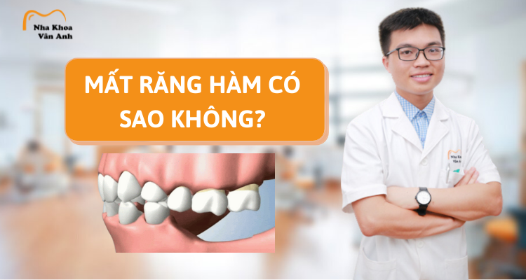 mat-rang-ham-co-sao-khong