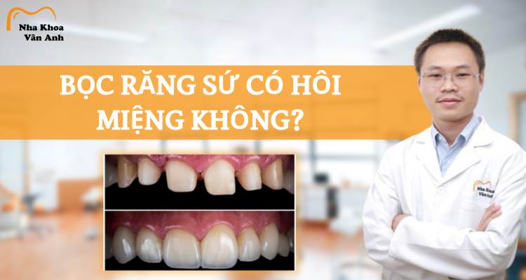 boc-rang-su-hoi-mieng-khong