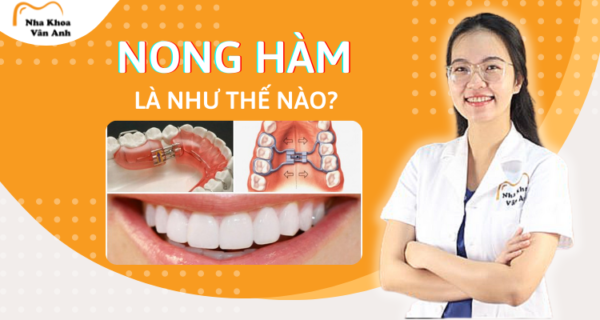 nong-ham-la-nhu-the-nao