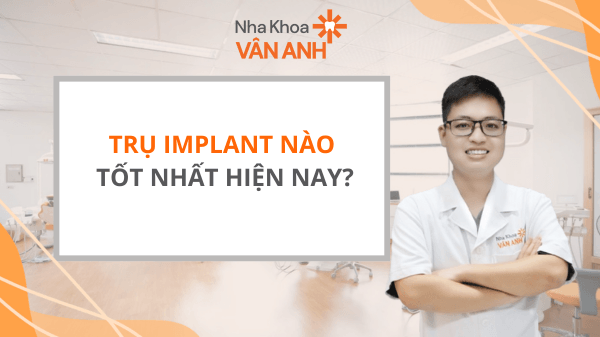 Trụ Implant nào tốt nhất hiện nay