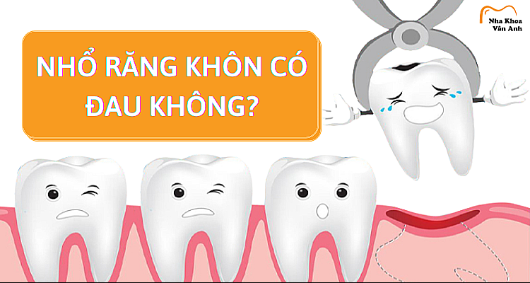 Nhổ răng khôn có đau không? 8 cách giảm đau hữu hiệu?