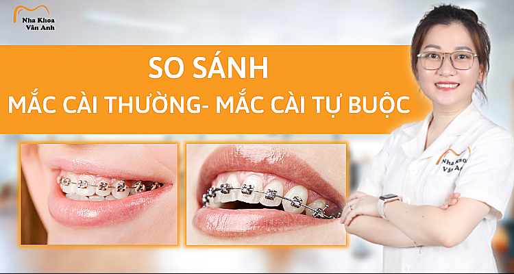 so-sanh-mac-cai-thuong-va-mac-cai-tu-buoc