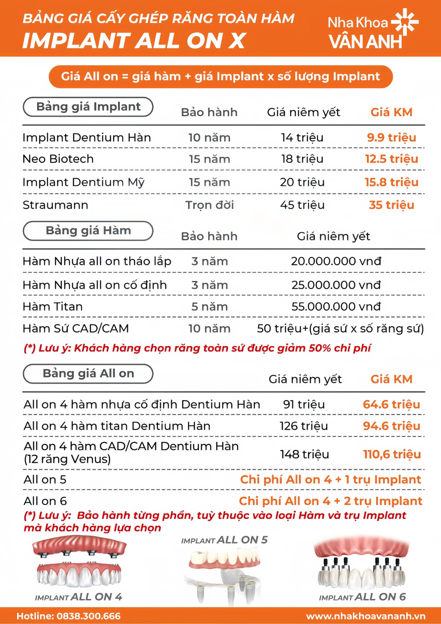  Trồng răng Implant All on 4 giá bao nhiêu