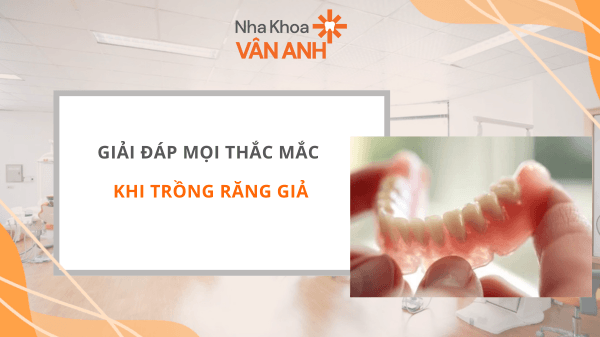 trồng răng giả