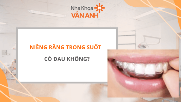 Niềng Răng Trong Suốt Có đau Không