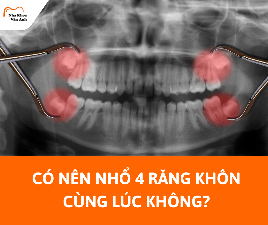co-nen-nho-4-rang-khon-cung-luc-khong