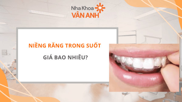 niềng răng trong suốt giá bao nhiêu