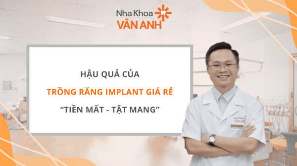 Trồng răng implant giá rẻ