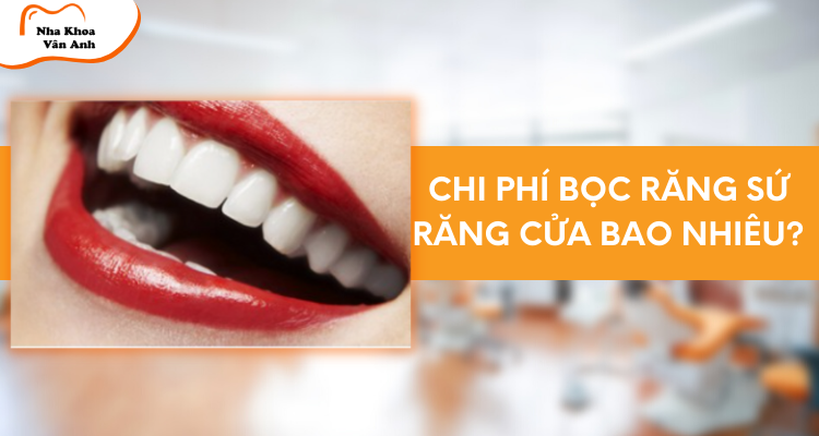 Chi phí bọc răng sứ răng cửa bao nhiêu? Nên lựa chọn răng sứ nào?