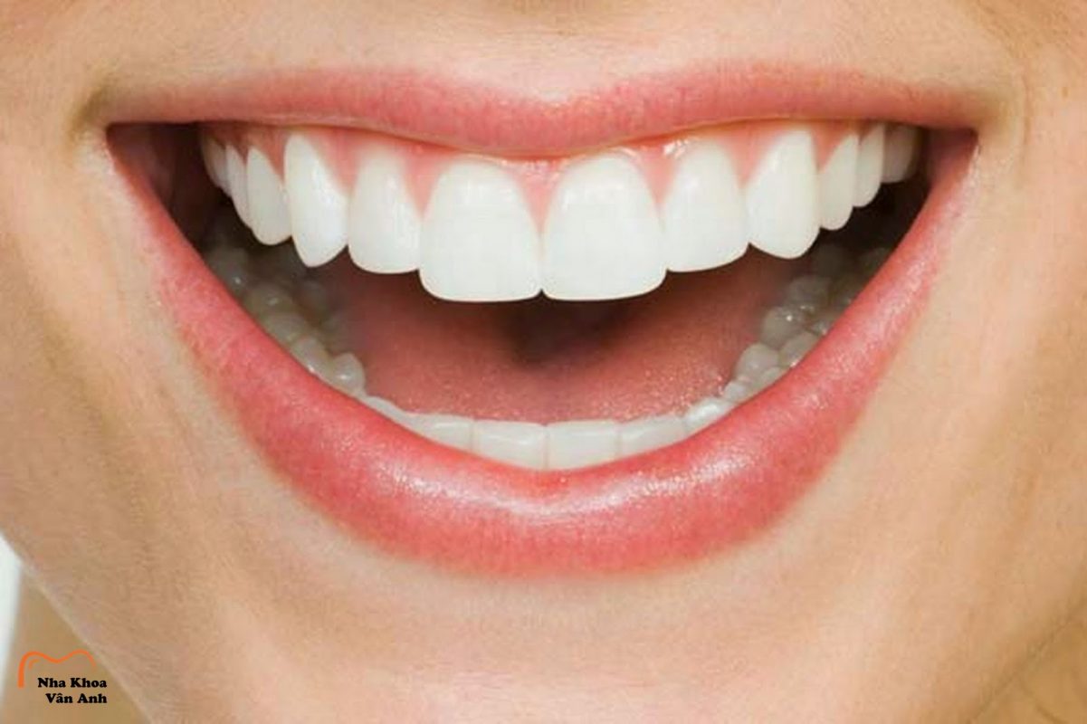 răng sứ katana