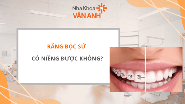răng bọc sứ có niềng được không