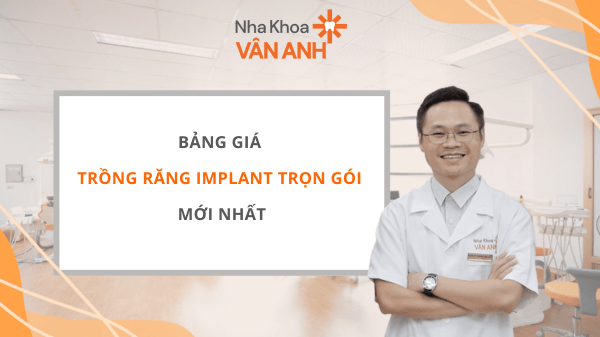 Bảng giá trồng răng implant trọn gói mới nhất
