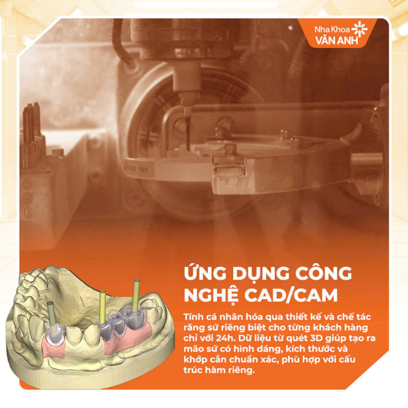 bọc răng sứ nha khoa vân anh