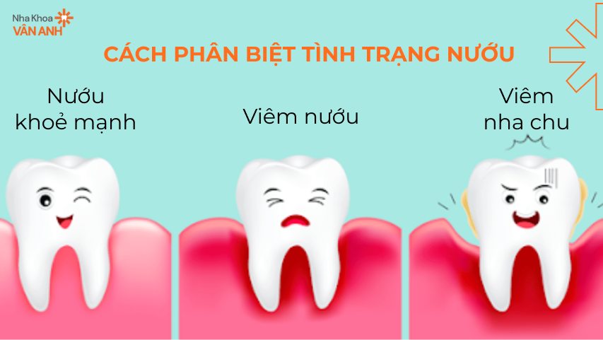 tinh-trang-nuou-dan-den-chay-mau-chan-rang