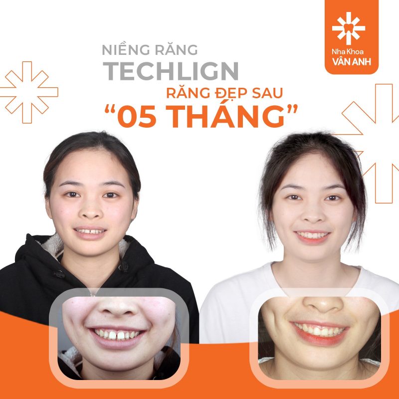 khach-hang-nieng-techlign