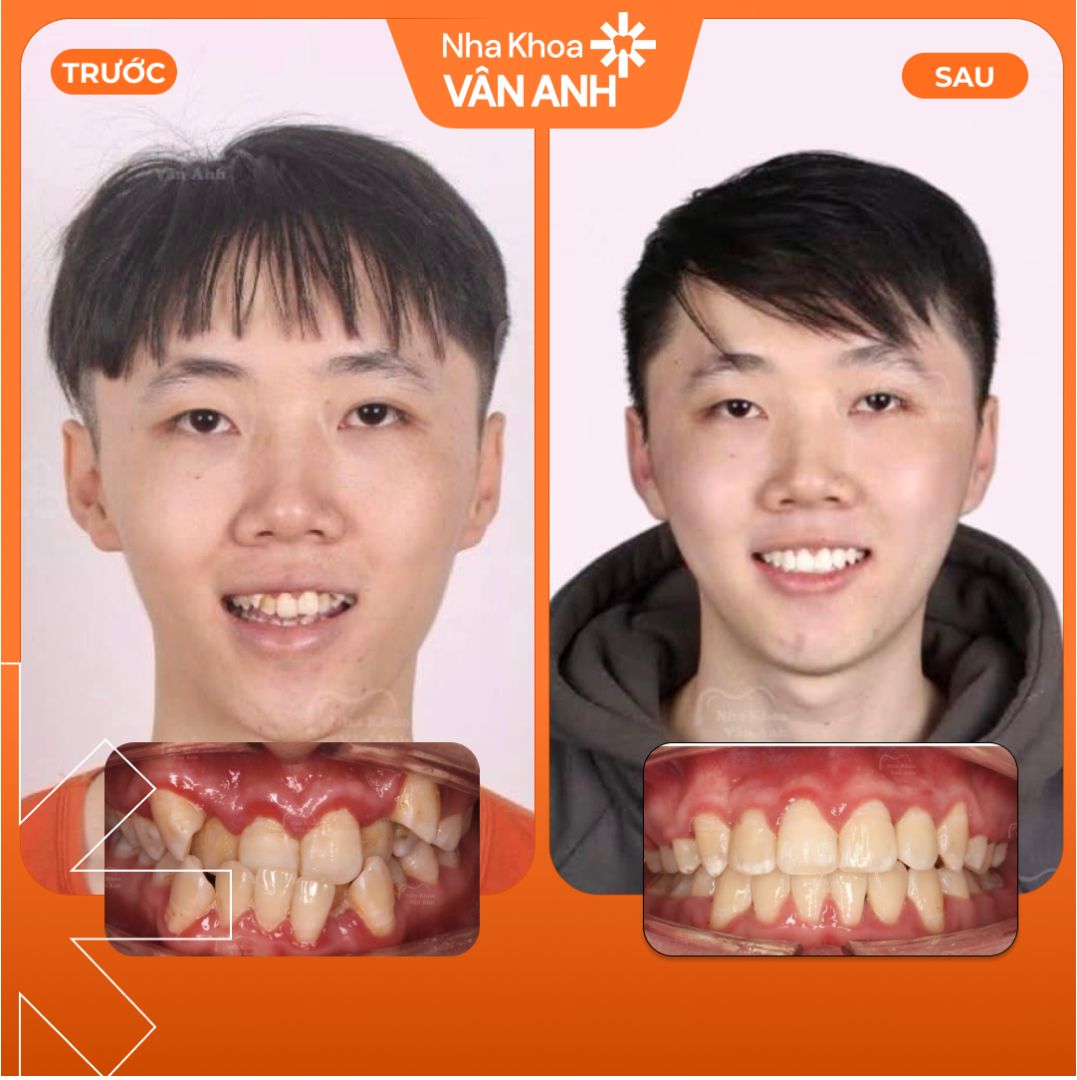 khach-hang-nieng-rang