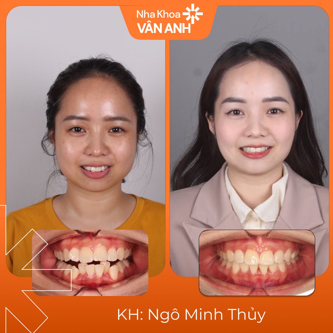 khach-hang-nieng-rang