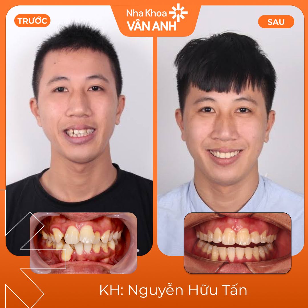 khach-hang-nieng-rang