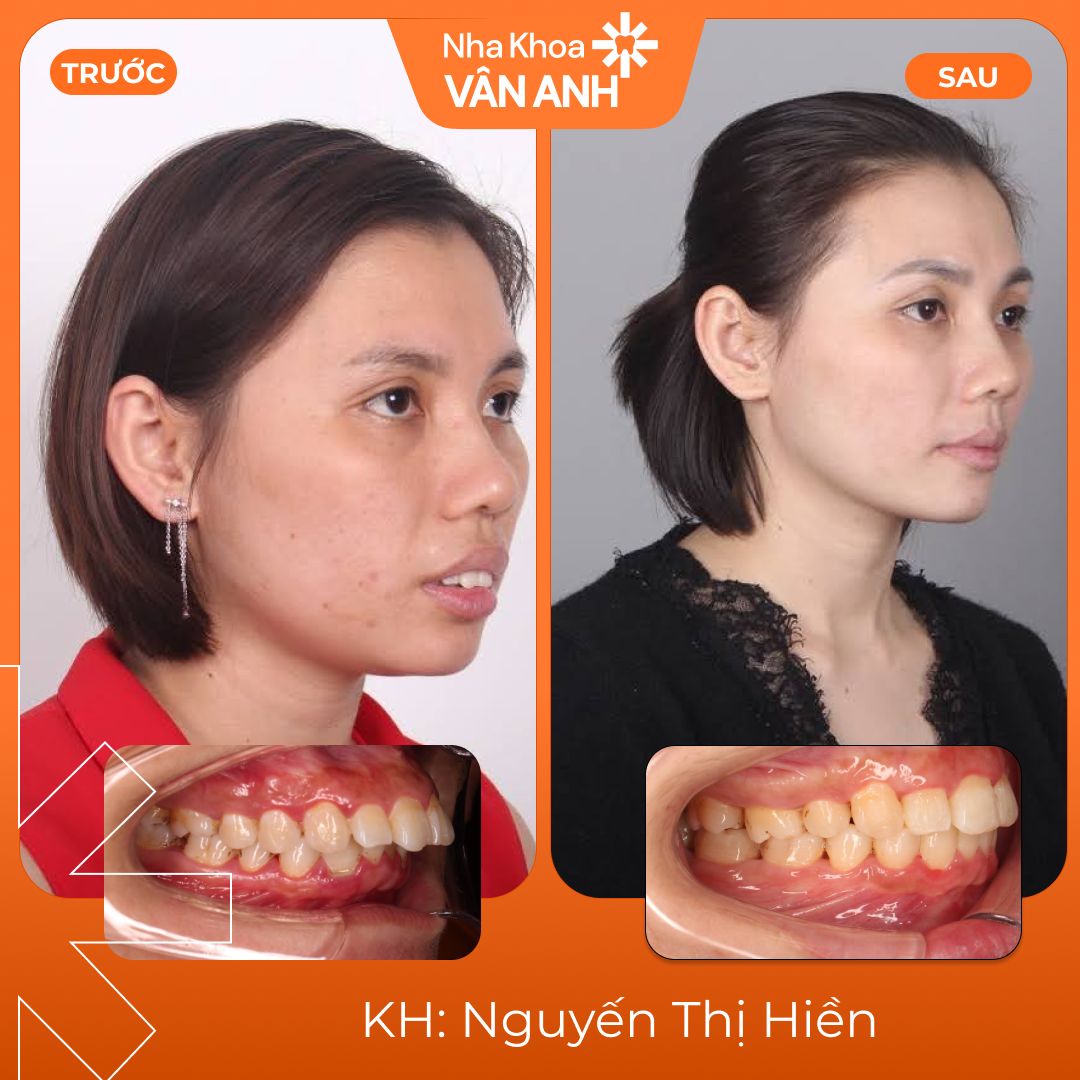 khach-hang-nieng-rang