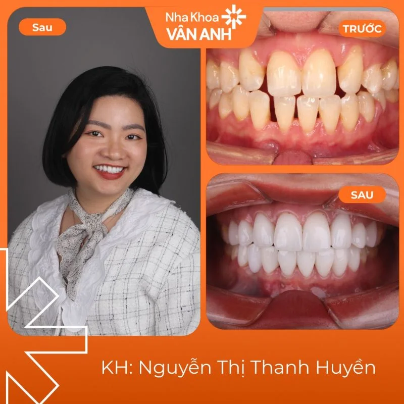 khach-hang-rang-su