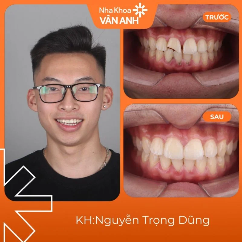 Khach-hang-rang-su