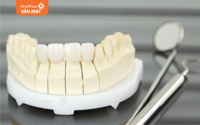 răng sứ thẩm mỹ