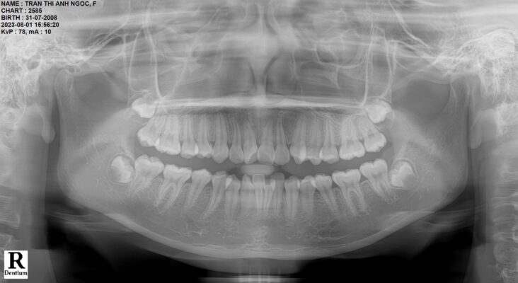 Phim toàn cảnh Panorama