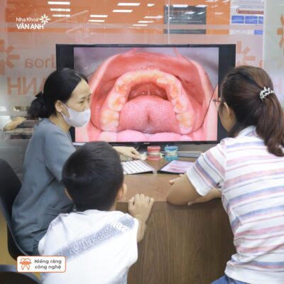 bs dịu
