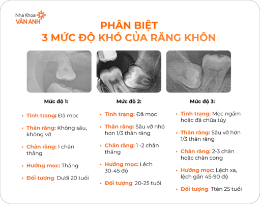 3-muc-do-rang-khon