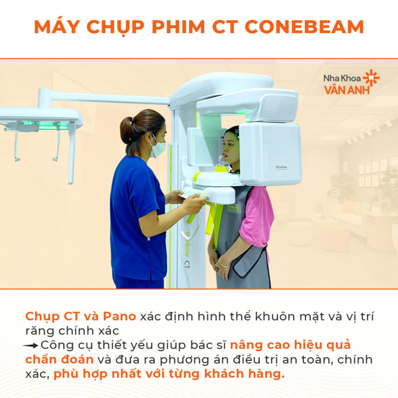 máy chụp phim CT Conebeam