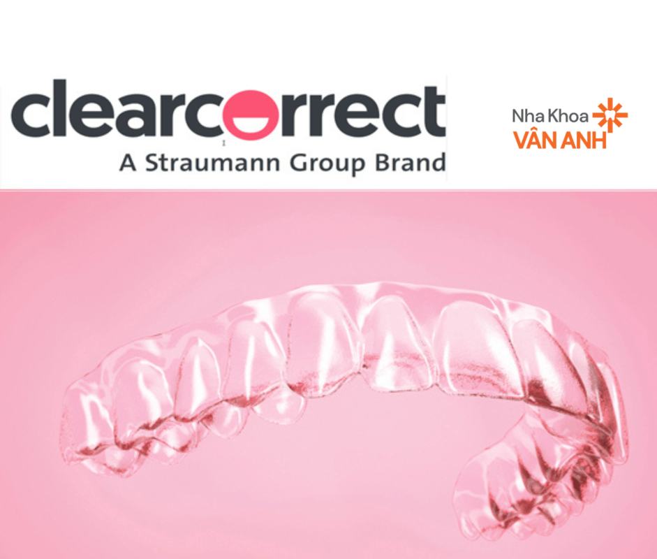 khay niềng trong suốt clearcorrect