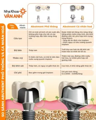 SO SÁNH ABUTMENT THƯỜNG VÀ ABUTMENT CÁ NHÂN HÓA