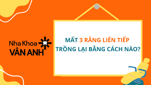 Mất 3 Răng Liên Tiếp