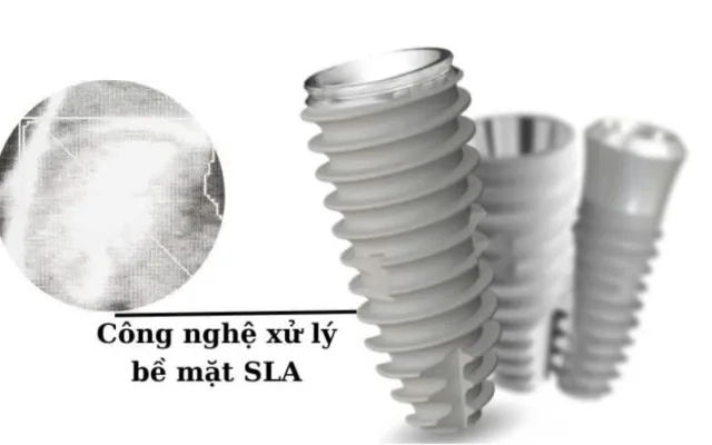 trụ implant
