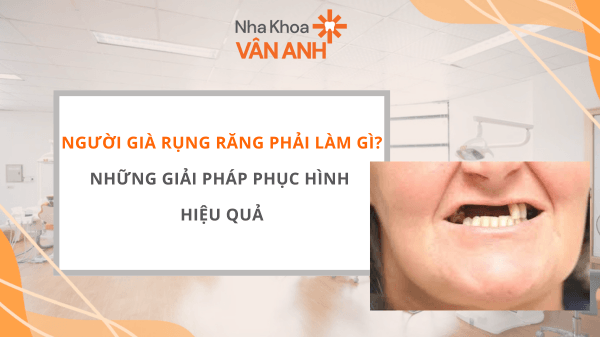 Người già rụng răng