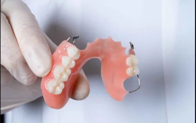 hàm tháo lắp nhựa cứng bán phần