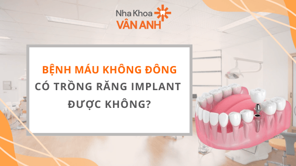 Bệnh máu không đông có trồng răng Implant được không