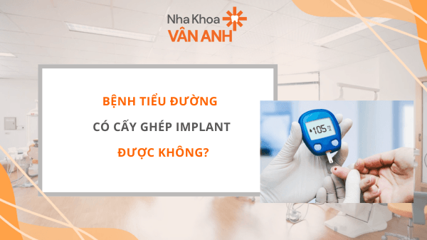 Bệnh tiểu đường có cấy ghép Implant được không