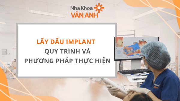 Lấy dấu implant