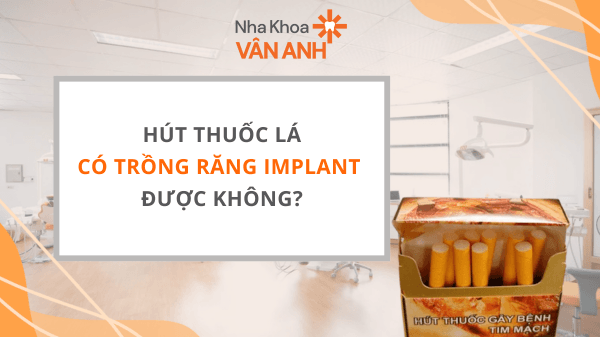 Người hút thuốc lá có trồng răng Implant được không
