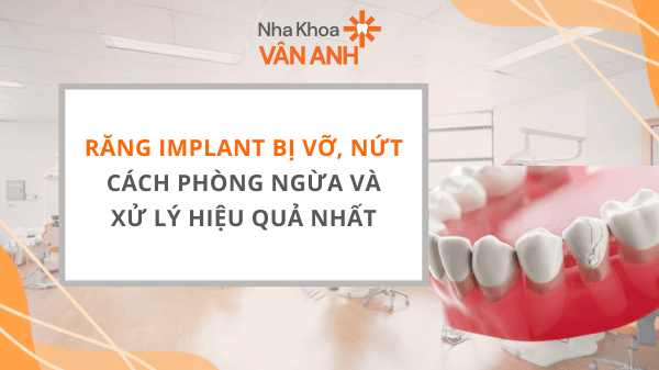 Răng Implant bị vỡ